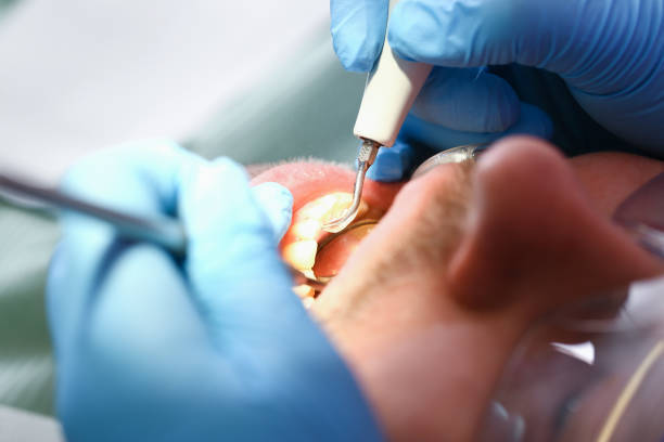 Best Mobile Emergency Dentist in Friendship Heights Village, MD