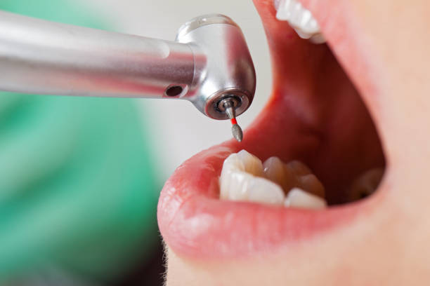 Best Weekend Emergency Dentist in Friendship Heights Village, MD